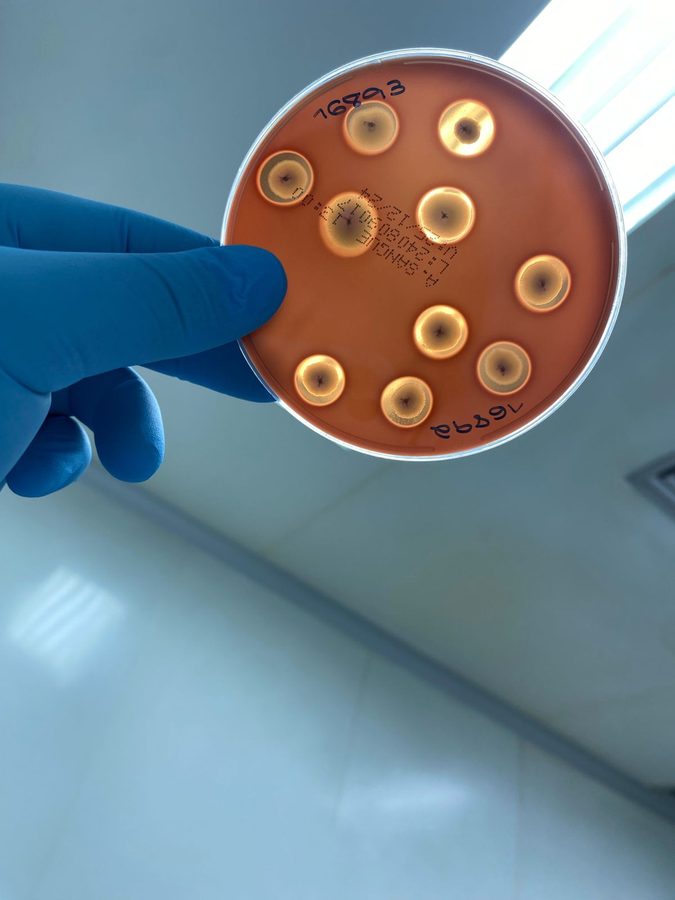 Bacillus cereus — hemólise em ágar sangue
