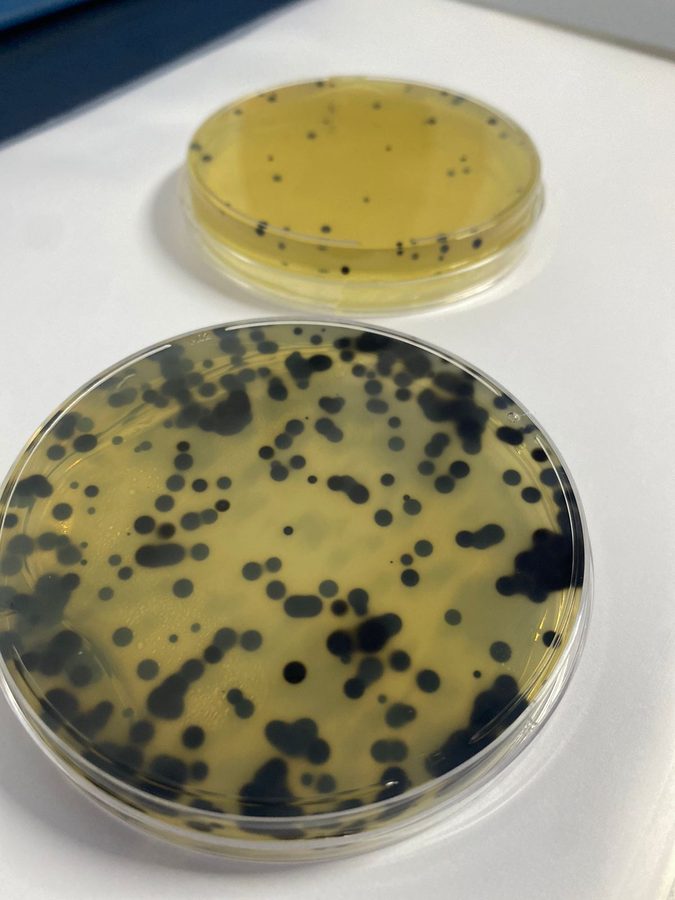 Clostridium perfringens