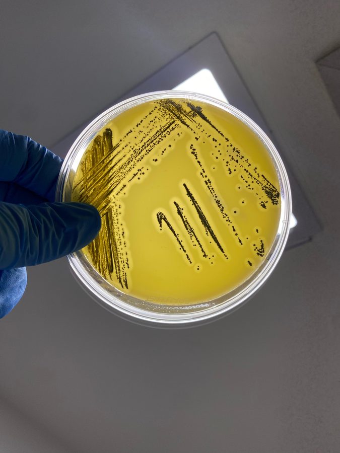 Staphylococcus aureus em Baird-Parker